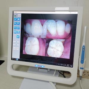 YF-1700P+ 17-calowy stomatologiczny aparat wewnątrzustny Dotykowy ekran LCD do u...