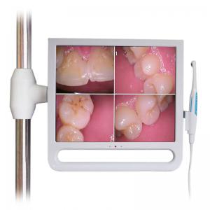 YF1700M 17-calowa stomatologiczna kamera wewnątrzustna z monitorem i uchwytem wspornikowym 1024*768 pikseli