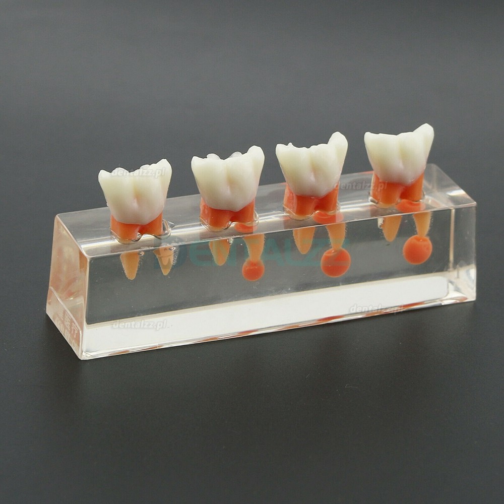 Model zębów dentystycznych 4-etapowe leczenie endodontyczne wykazuje anatomiczny charakter M4018-01