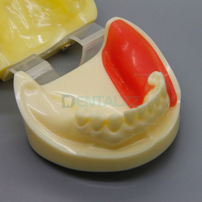 Praktyka wiercenia implantów dentystycznych Model szczęki Typodont ze zdejmowanym dziąsłem 2002