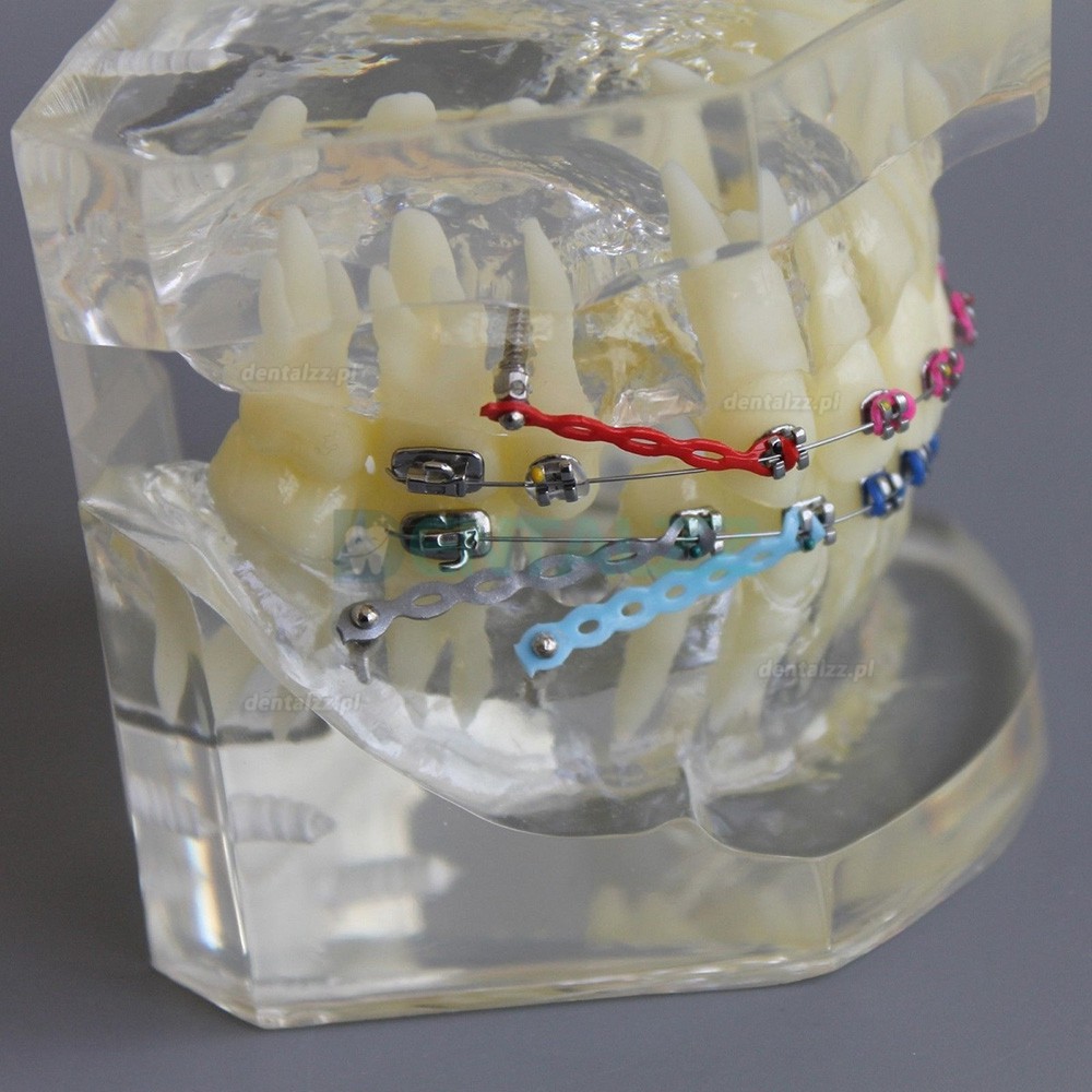 Model praktyki demonstracyjnej ortodoncji stomatologicznej z metalowym wspornikiem łuku M3005 02