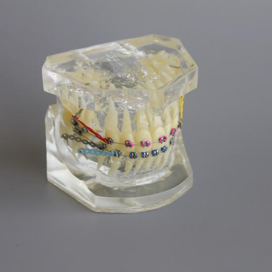 Model praktyki demonstracyjnej ortodoncji stomatologicznej z metalowym wspornikiem łuku M3005 02