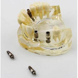 Badanie Chirurgii Implantów Górnej Szczęki Dentystycznej Model Dem 2005