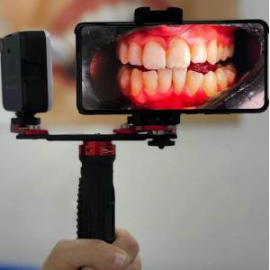 Regulacja dentystyczna fotografia ustna lampa błyskowa telefon komórkowy fotografia dentystyczna wypełnij światłem