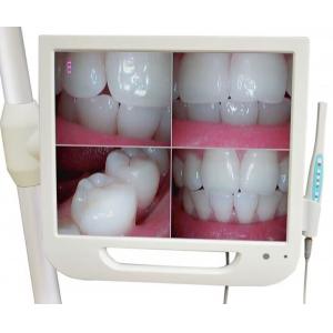 17-calowy cyfrowy monitor LCD AIO o wysokiej rozdzielczości Dental wewnątrzustna kamera