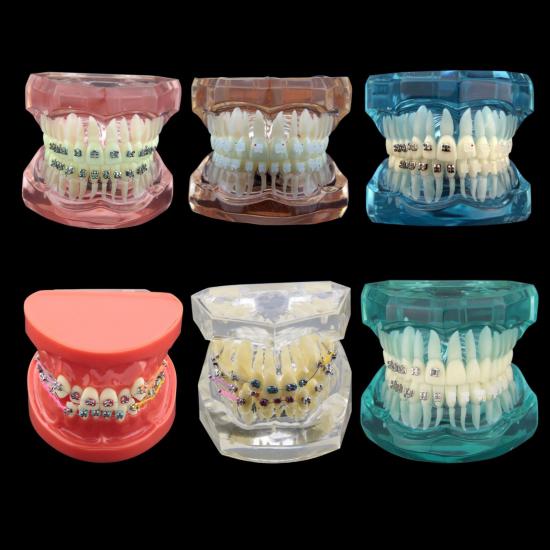 Dentystyczne leczenie ortodontyczne demonstracyjne model zębów Dentystyczne leczenie ortodontyczne demonstracyjne model zębów