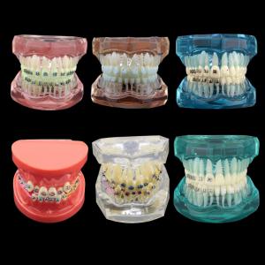 Dentystyczne leczenie ortodontyczne demonstracyjne model zębów