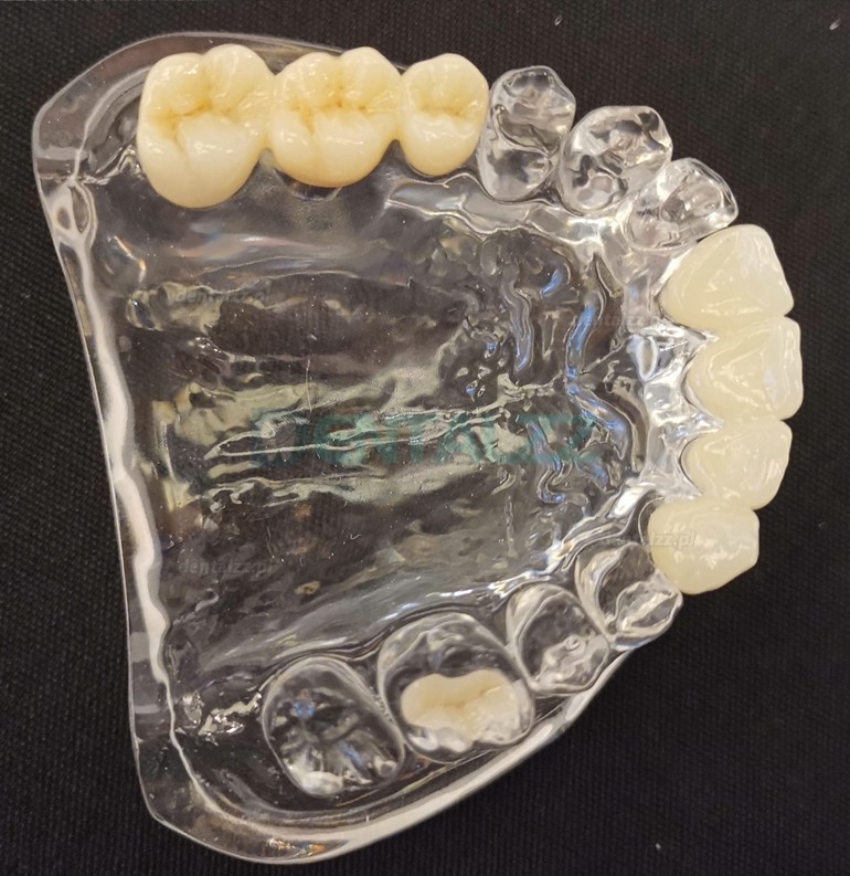 1 szt. 3D laboratorium dentystyczne wielowarstwowy blok tlenku cyrkonu CAD/CAM blok ceramiczny