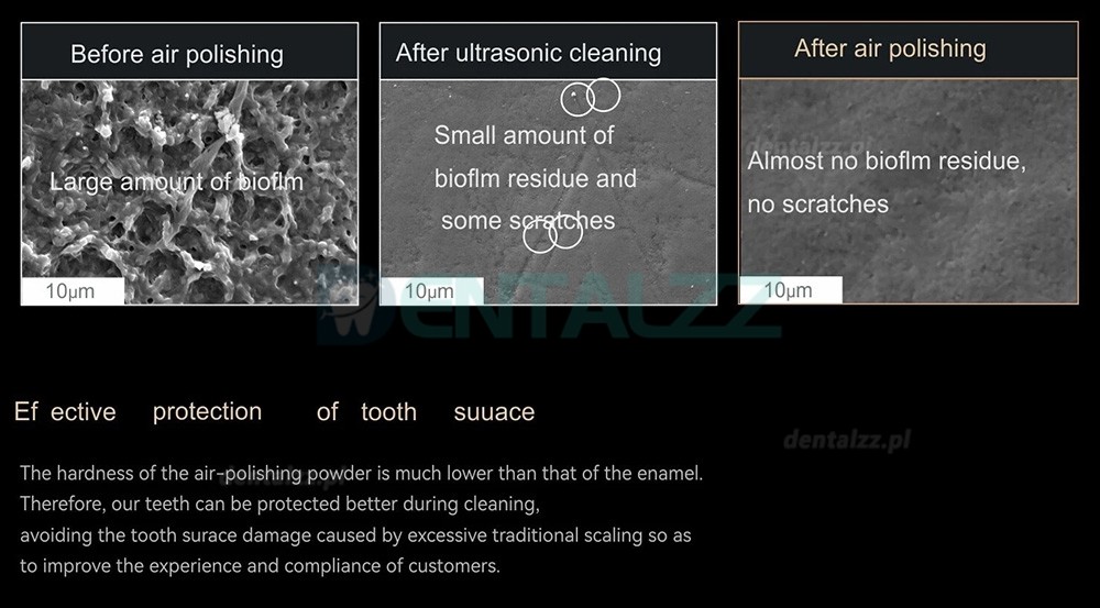 Woodpecker AP-H Plus Piaskarka Stomatologiczna do Profilaktyki Naddziąsłowej i Poddziąsłowej