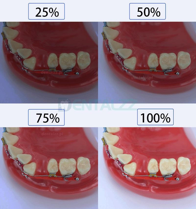 Regulacja dentystyczna fotografia ustna lampa błyskowa telefon komórkowy fotografia dentystyczna wypełnij światłem