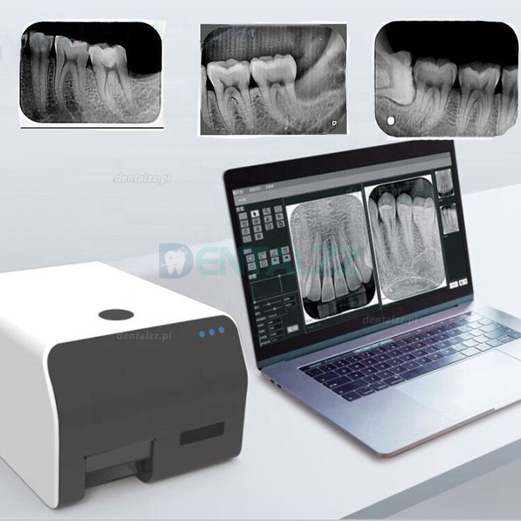 VRN EQ-600 Cyfrowy PSP Skaner płyt fosforowych system skanera płyt dentystycznych z fosforem