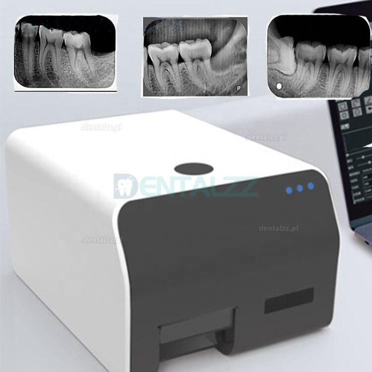 VRN EQ-600 Cyfrowy PSP Skaner płyt fosforowych system skanera płyt dentystycznych z fosforem