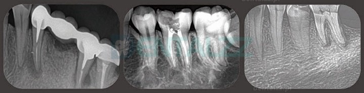 Fussen F200 Skaner płyt fosforowych skaner PSP do obrazowania rentgenowskiego dentystycznego