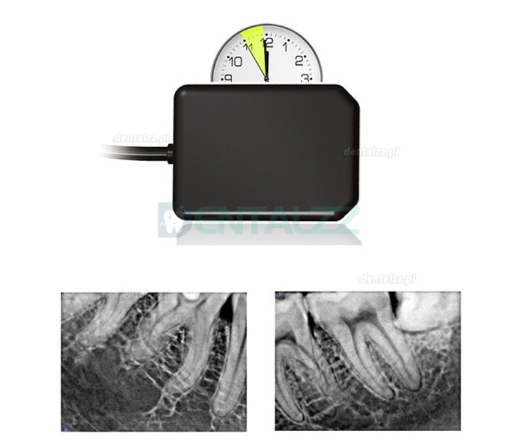 Przenośny aparat rtg stomatologiczny AD-60P + Handy HDR 500 cyfrowy czujnik stomatologiczny