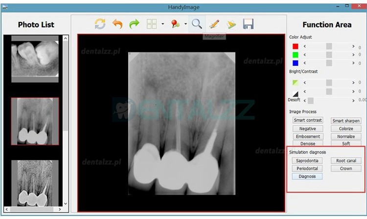 Cyfrowy czujnik rentgenowski o wysokiej rozdzielczości typu USB Rvg HDR 500 Cyfrowy czujnik rentgenowski o wysokiej rozdzielczości typu USB Rvg HDR 500