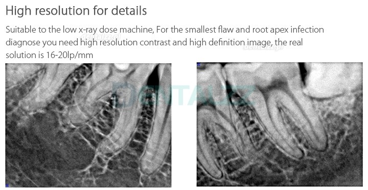 Handy HDR-600 Cyfrowy dentystyczny czujnik rentgenowski wewnątrzustny system obrazowania rentgenowskiego