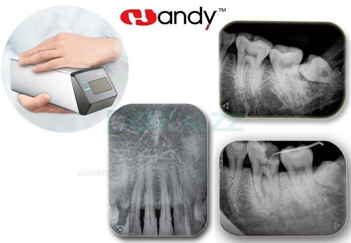 Handy HDS-500 Skaner płyt fosforowych PSP cyfrowy skaner płytek fosforowych do obrazowania dentystycznego