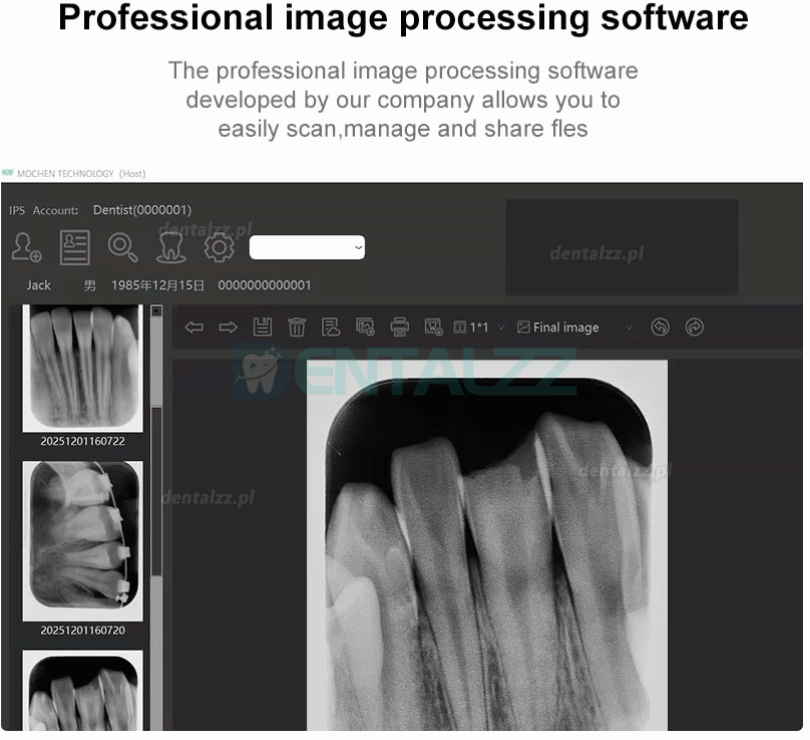 Handy IPS3 Skaner PSP Stomatologiczny Cyfrowy do Obrazowania RTG Handy IPS3 Skaner PSP Stomatologiczny Cyfrowy do Obrazowania RTG