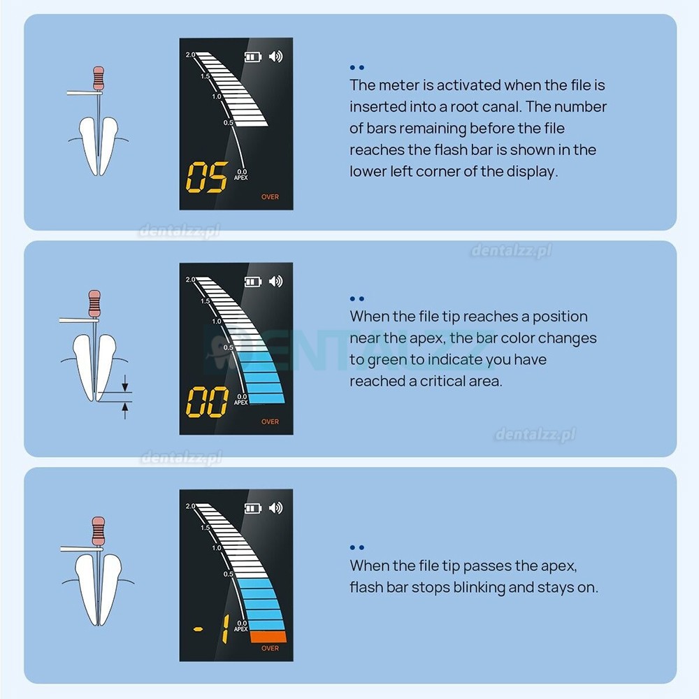 Micropex Pro endometr stomatologiczny endodontyczny lokalizator wierzchołka