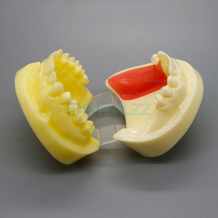 Praktyka wiercenia implantów dentystycznych Model szczęki Typodont ze zdejmowanym dziąsłem 2002