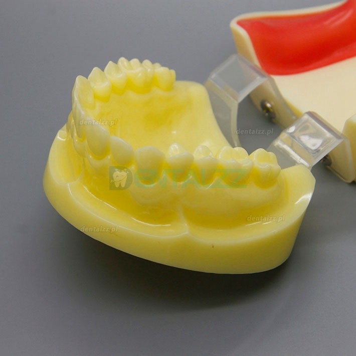 Praktyka wiercenia implantów dentystycznych Model szczęki Typodont ze zdejmowanym dziąsłem 2002