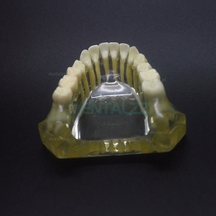 Badanie implantów dentystycznych Model Typodont Most korony dolnej szczęki 2010