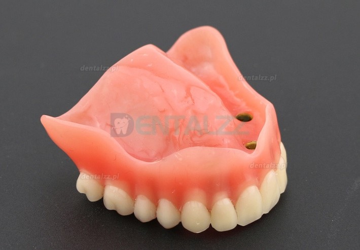 Badanie dentystyczne Model zębów Overdenture Superior z 4 implantami Model demonstracyjny 6001