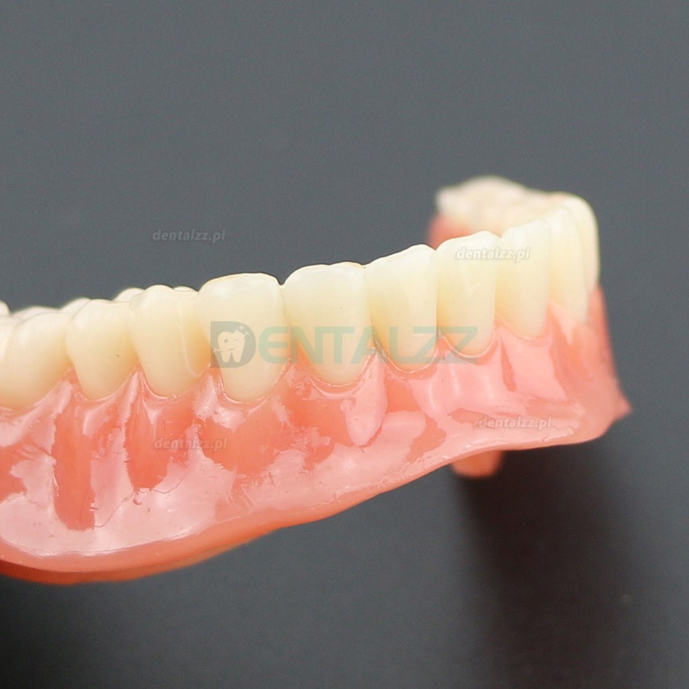 Model badania dentystycznego zębów dolnych 6002 02 Implanty Overdenture Inferior 4