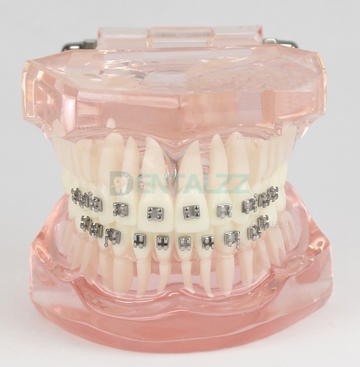 Wada zgryzu zębów dentystycznych poprawna za pomocą metalowego wspornika Model standardowy M3001