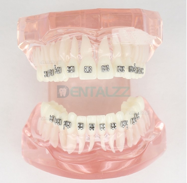 Wada zgryzu zębów dentystycznych poprawna za pomocą metalowego wspornika Model standardowy M3001