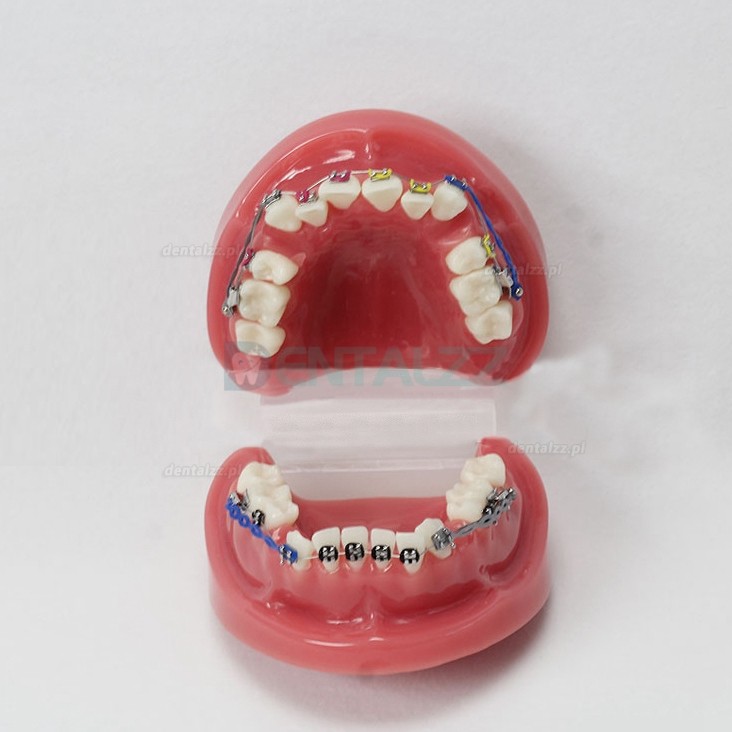 Korekcja wad zgryzu zębów dentystycznych za pomocą wspornika zębów Standardowy model M3005