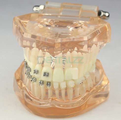 Model dentystyczny ortodontyczny z zamkami ceramicznymi M3009
