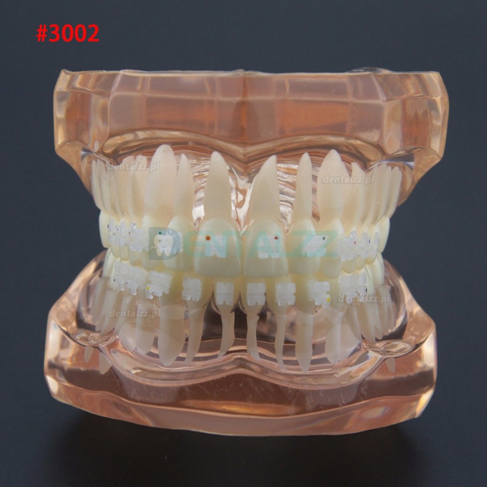 Dentystyczne leczenie ortodontyczne demonstracyjne model zębów