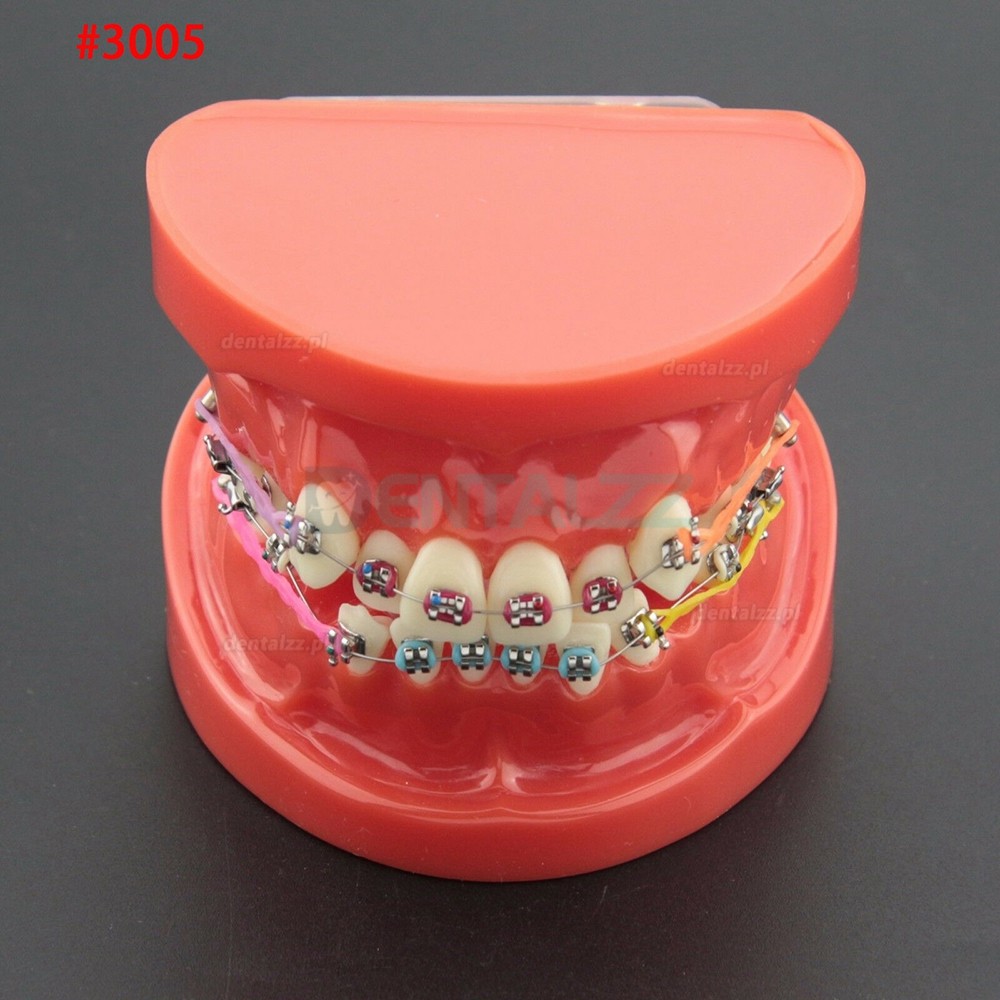 Dentystyczne leczenie ortodontyczne demonstracyjne model zębów