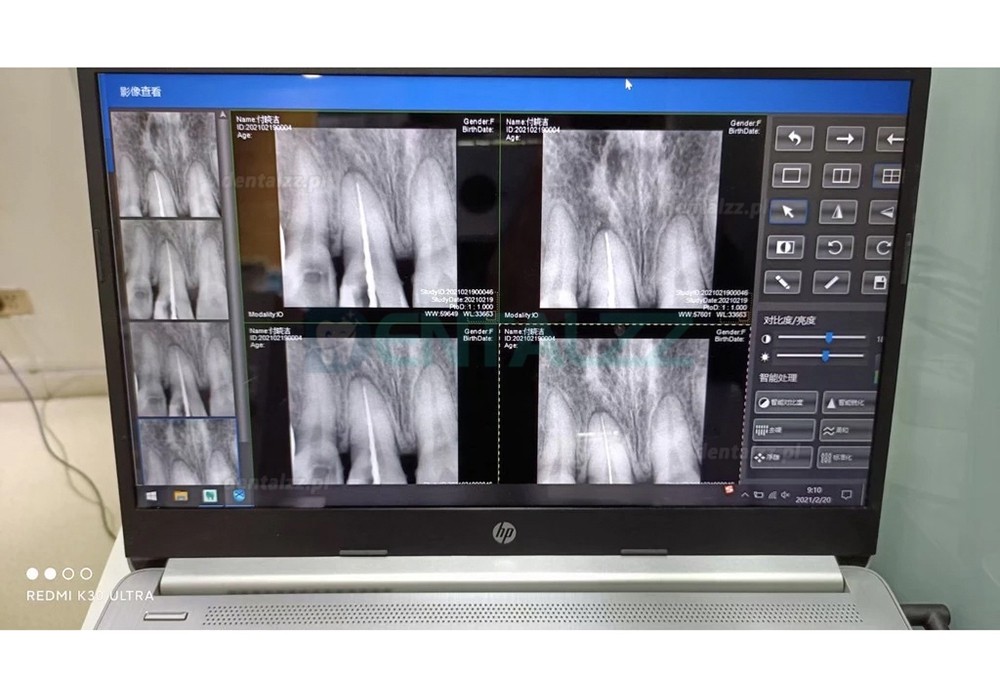 Cyfrowy czujnik stomatologiczny RVG system obrazowania wewnątrzustnego dentystycznego