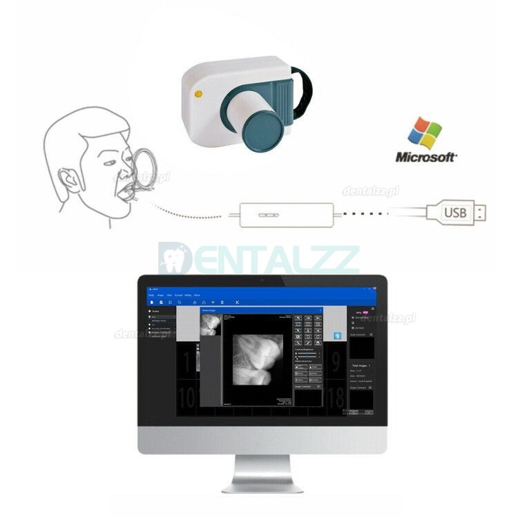 Cyfrowy czujnik stomatologiczny RVG system obrazowania wewnątrzustnego dentystycznego
