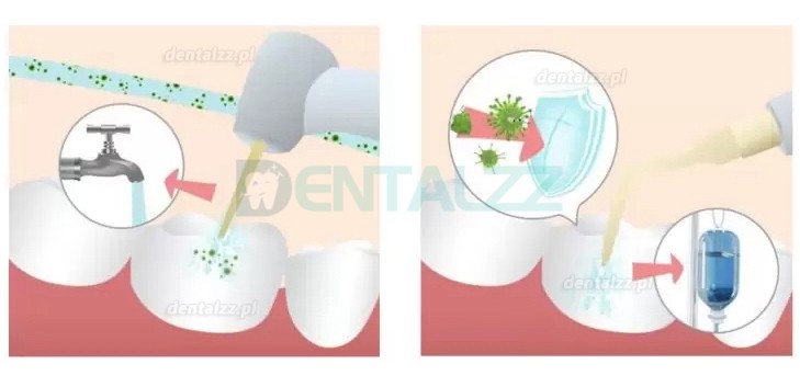 Refine MaxSurgery Urządzenie do piezochirurgii stomatologicznej ultradźwiękowy system piezochirurgii kości