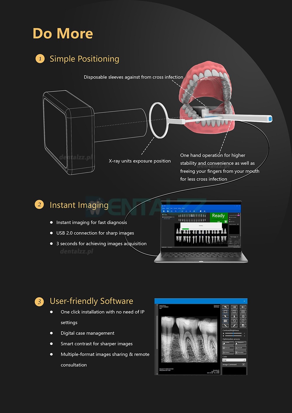 Cyfrowy czujnik stomatologiczny RVG system obrazowania wewnątrzustnego dentystycznego