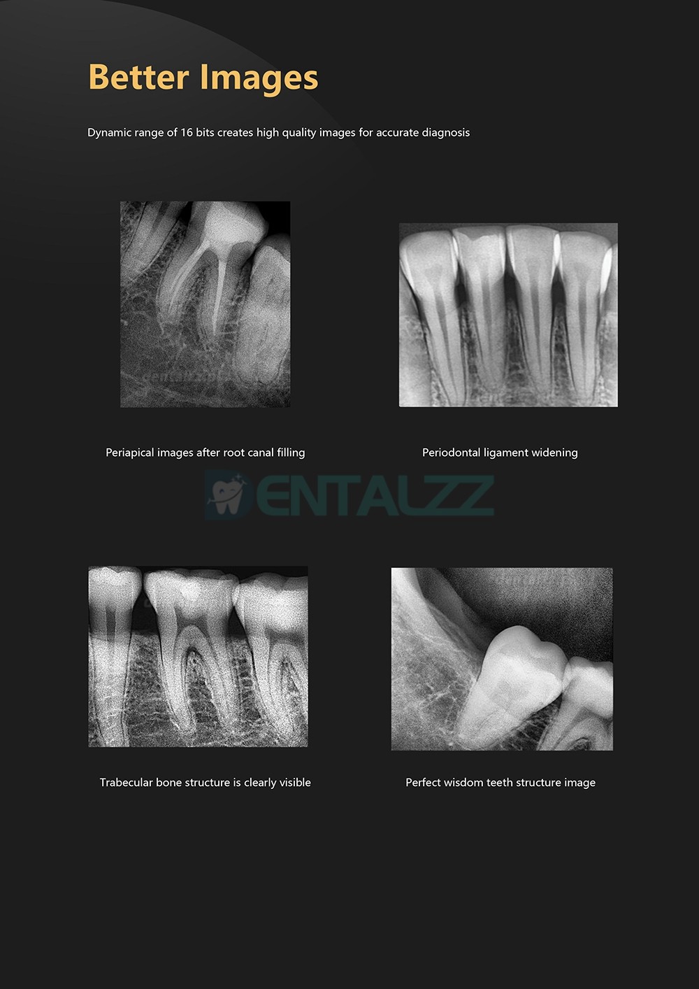 Cyfrowy czujnik stomatologiczny RVG system obrazowania wewnątrzustnego dentystycznego