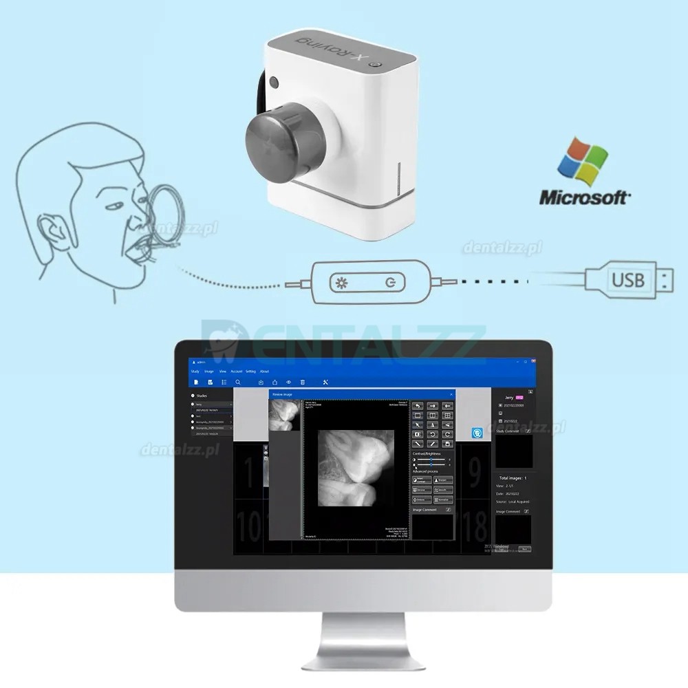 Cyfrowy czujnik stomatologiczny RVG system obrazowania wewnątrzustnego dentystycznego